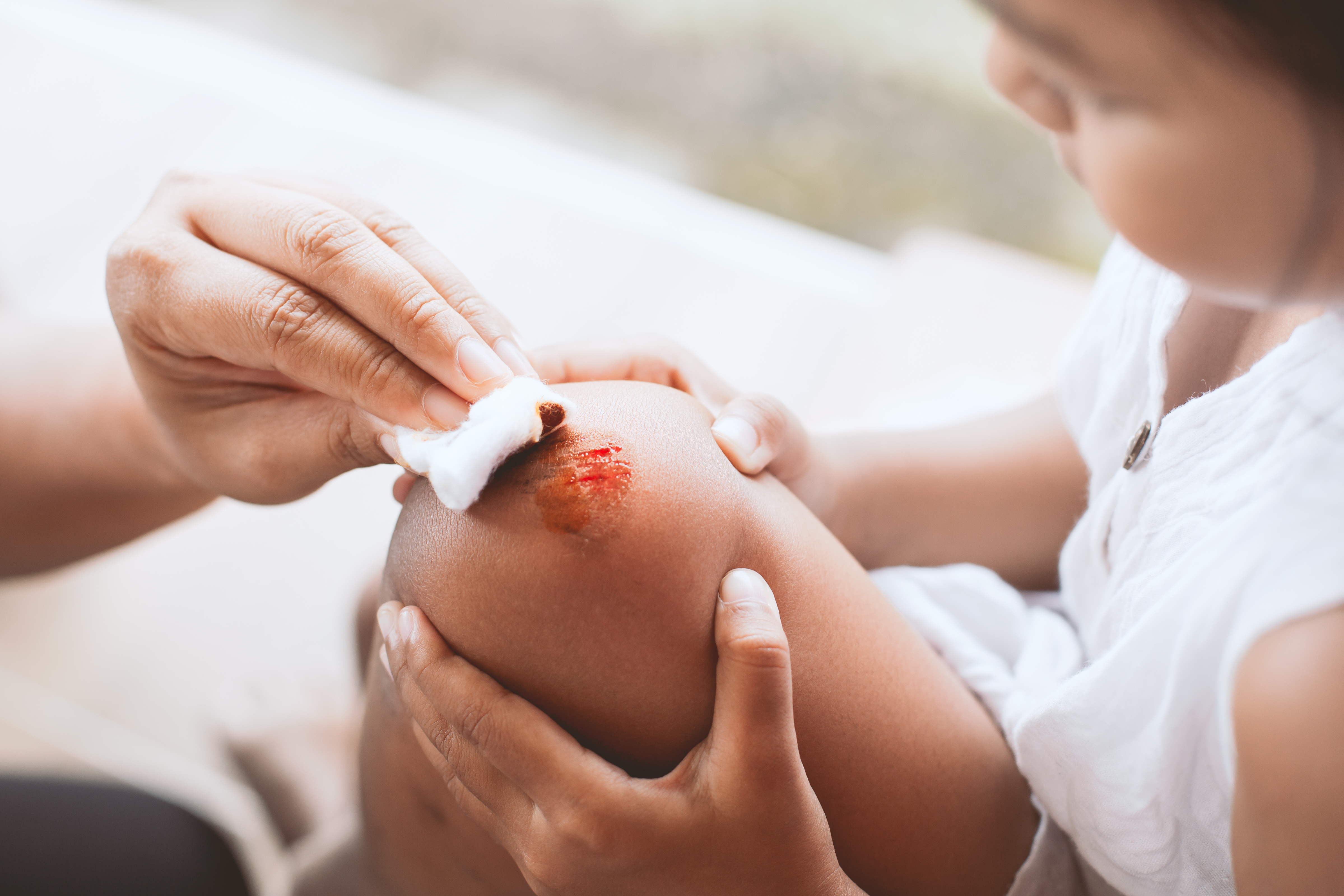 How to Clean a Wound
